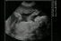 poster-10921-spa-le-foetus-68x45