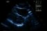 poster-2235-joy-lubricated-condom-echographie-68x45