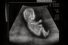 poster-79-valvoline-ultrasound-68x45