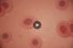 Blood-cells-68x45